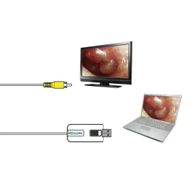 Videotoskop MD SCOPE  z 4 sondami