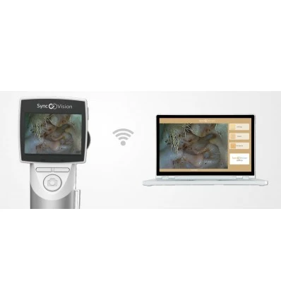 Videootoskop I01 Elite SyncVision