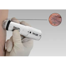 Bezprzewodowy Dermatoskop Dino-Lite z polaryzacją MEDLW4DW (VideoDermatoskop)