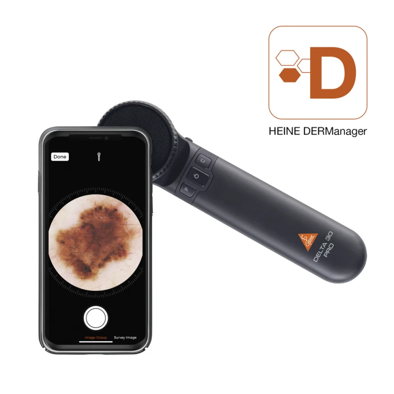 Dermatoskop Heine mini 3000 LED - SKLEP DLA LEKARZA