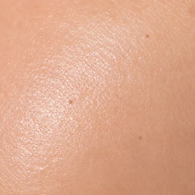 Dermatoskop LuxaScope LED - SKLEP DLA LEKARZA