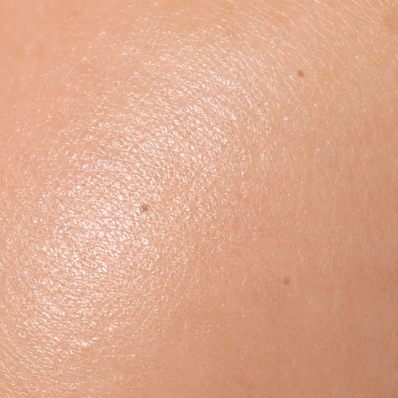 Dermatoskop LuxaScope LED - SKLEP DLA LEKARZA