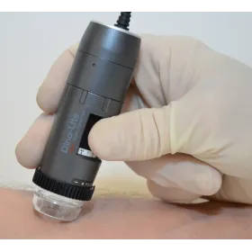 Dermatoskop Dino-Lite (VideoDermatoskop)
