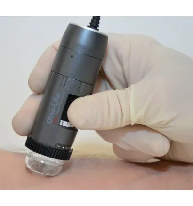 Dermatoskop Dino-Lite (VideoDermatoskop)