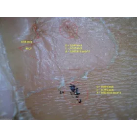Dermatoskop Dino-Lite (VideoDermatoskop)