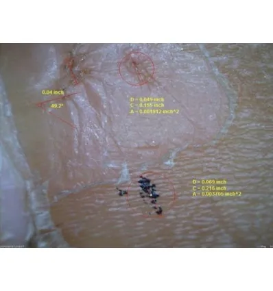 Dermatoskop Dino-Lite (VideoDermatoskop)