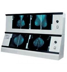Negatoskop 2 x NGP - 21 m, do mamografii (bez żaluzji) (2xNGP-21m)