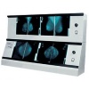 Negatoskop 2 x NGP - 21 m, do mamografii (bez żaluzji) (2xNGP-21m) 