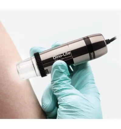 Dermatoskop Dino-Lite z polaryzacją MEDL7DW (VideoDermatoskop) HR